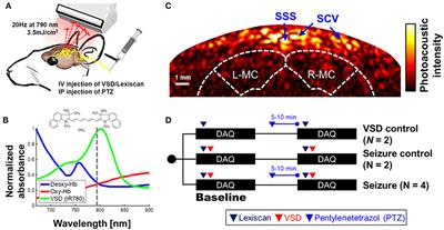 Transcranial Recording of Electrophysiological Neural Activity in the Rodent Brain in vivo Using Functional Photoacoustic Imaging of Near-Infrared Voltage-Sensitive Dye